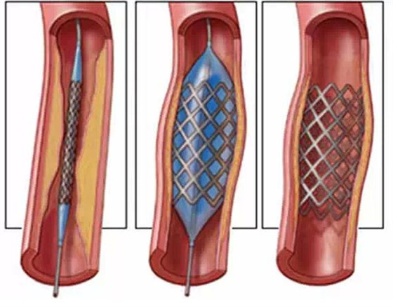 愛旺工業醫療行業設備案例 愛旺工業醫療行業設備案例